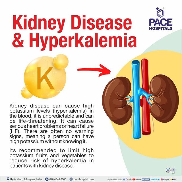 Effective Ways to Lower Potassium Levels for Better Health in 2025